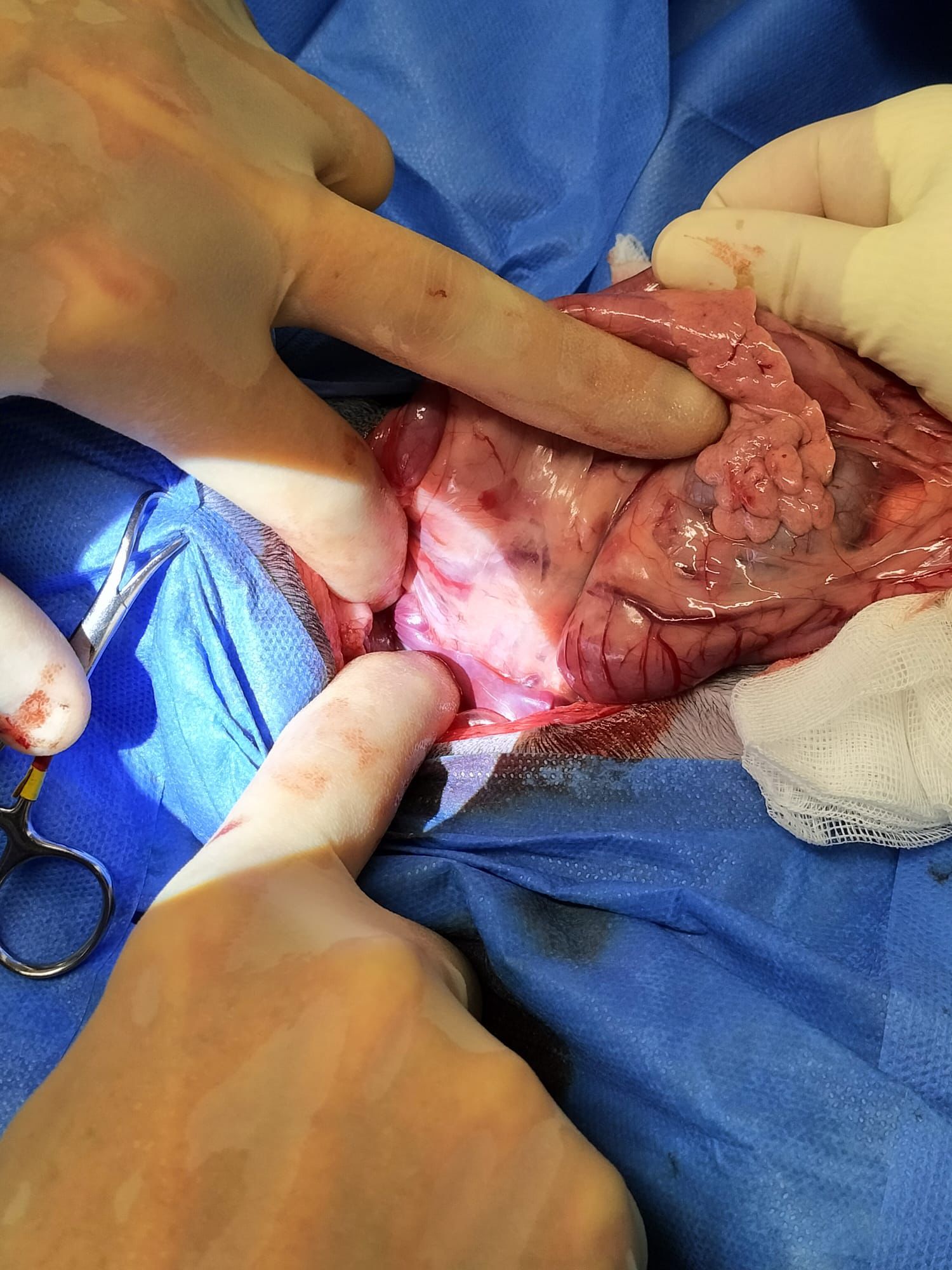 Porto systemic shunt intra-operative picture